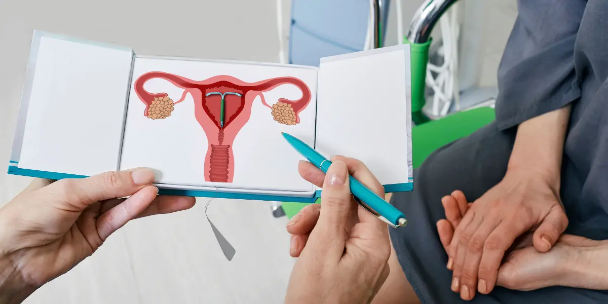 Métodos contraceptivos de longa duração