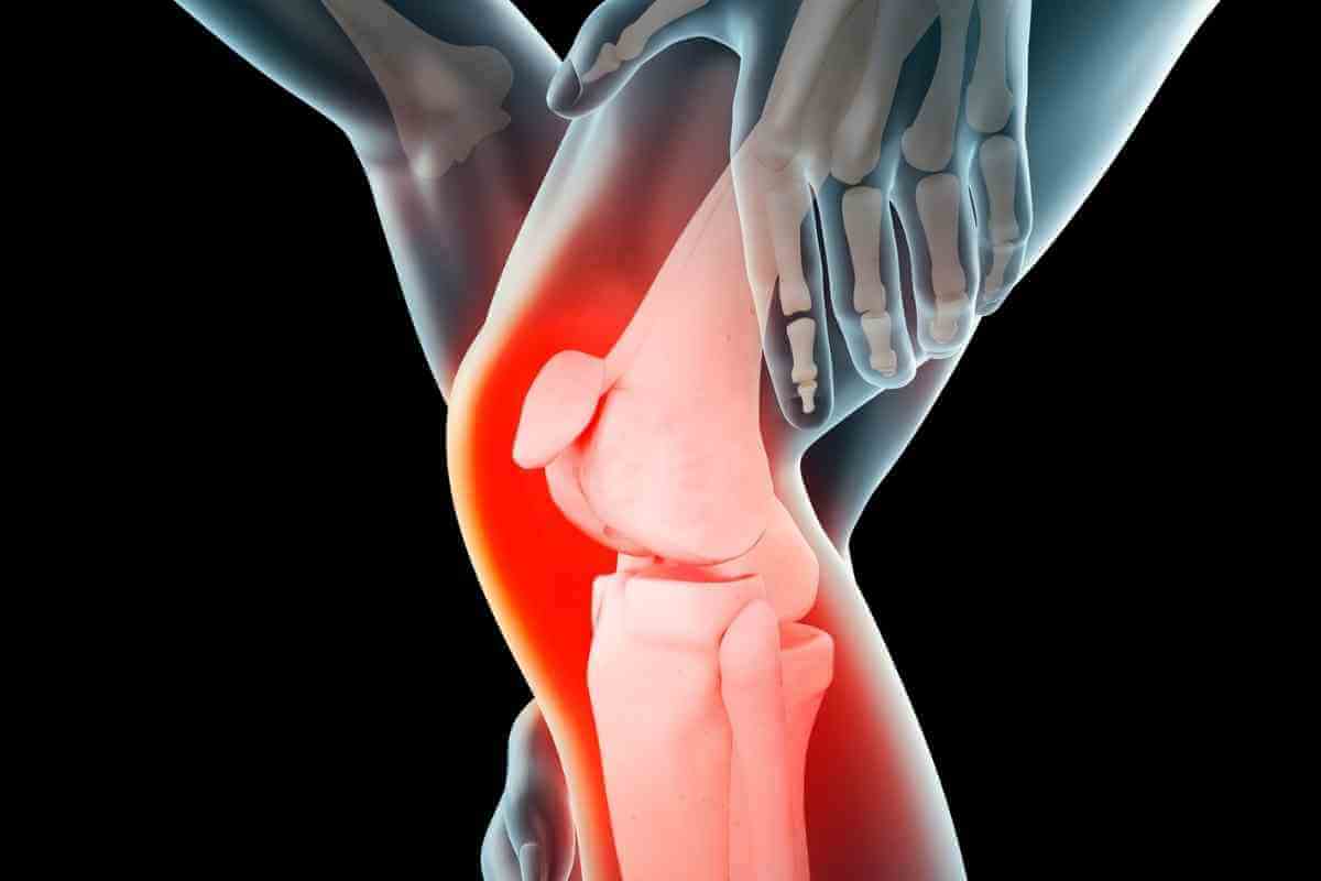 como-saber-ligamento-joelho-rompido