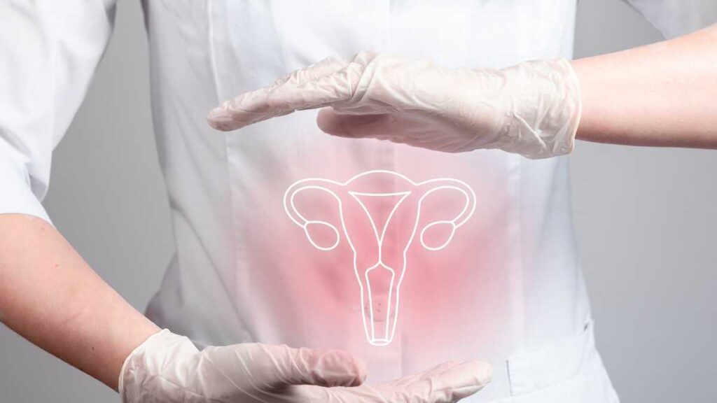 O que causa a endometriose