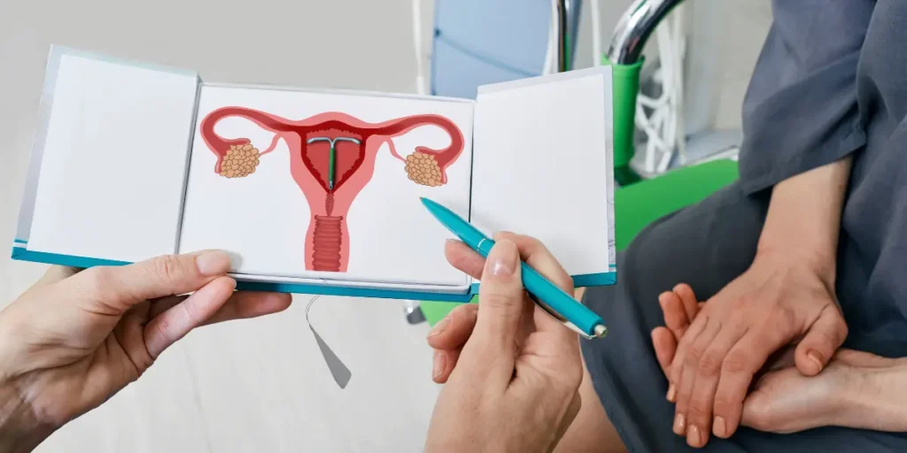 Métodos contraceptivos de longa duração