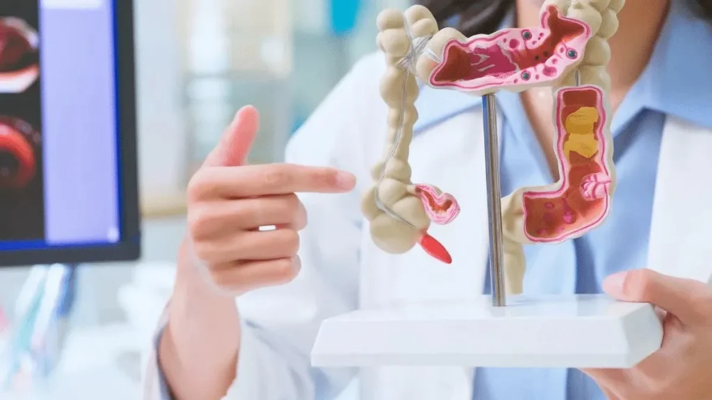 Intestino saudável em 30 dias? Médica revela hábitos Intestino saudável em 30 dias? Médica revela hábitos